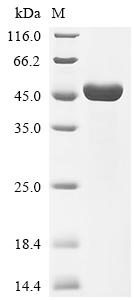 (Tris-Glycine gel) Discontinuous SDS-PAGE (reduced) with 5% enrichment gel and 15% separation gel.