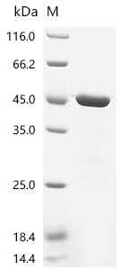 (Tris-Glycine gel) Discontinuous SDS-PAGE (reduced) with 5% enrichment gel and 15% separation gel.