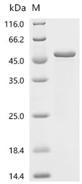 (Tris-Glycine gel) Discontinuous SDS-PAGE (reduced) with 5% enrichment gel and 15% separation gel.