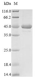 (Tris-Glycine gel) Discontinuous SDS-PAGE (reduced) with 5% enrichment gel and 15% separation gel.