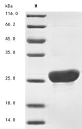 (Tris-Glycine gel) Discontinuous SDS-PAGE (reduced) with 5% enrichment gel and 15% separation gel.