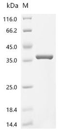 (Tris-Glycine gel) Discontinuous SDS-PAGE (reduced) with 5% enrichment gel and 15% separation gel.