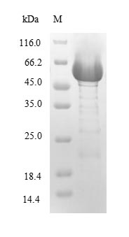(Tris-Glycine gel) Discontinuous SDS-PAGE (reduced) with 5% enrichment gel and 15% separation gel.