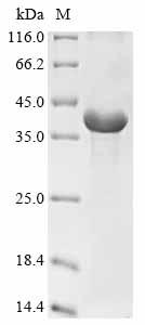 (Tris-Glycine gel) Discontinuous SDS-PAGE (reduced) with 5% enrichment gel and 15% separation gel.