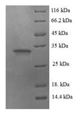 (Tris-Glycine gel) Discontinuous SDS-PAGE (reduced) with 5% enrichment gel and 15% separation gel.