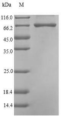 Recombinant Pseudomonas sp. Carboxypeptidase G2 (cpg2) – Figure 1 of 1