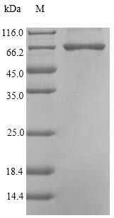 Recombinant Pseudomonas sp. Carboxypeptidase G2 (cpg2) – Figure 1 of 1