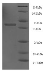 Recombinant Saccharomyces cerevisiae DNA repair and recombination protein RAD52 (RAD52), partial – Figure 1 of 1