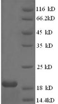 Recombinant Human papillomavirus type 18 Protein E7 (E7) – Figure 1 of 1