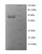 Recombinant Human papillomavirus type 18 Regulatory protein E2 (E2) – Figure 1 of 1