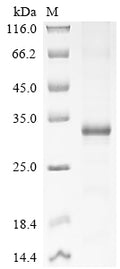 (Tris-Glycine gel) Discontinuous SDS-PAGE (reduced) with 5% enrichment gel and 15% separation gel.