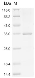 (Tris-Glycine gel) Discontinuous SDS-PAGE (reduced) with 5% enrichment gel and 15% separation gel.