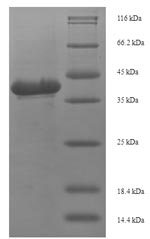 Recombinant Staphylococcus aureus Toxic shock syndrome toxin-1 (tst) – Figure 1 of 1