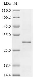 (Tris-Glycine gel) Discontinuous SDS-PAGE (reduced) with 5% enrichment gel and 15% separation gel.
