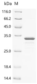 (Tris-Glycine gel) Discontinuous SDS-PAGE (reduced) with 5% enrichment gel and 15% separation gel.
