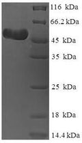 Recombinant Human rhinovirus A serotype 89 Genome polyprotein, partial – Figure 1 of 1