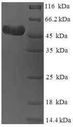 Recombinant Human rhinovirus A serotype 89 Genome polyprotein, partial – Figure 1 of 1