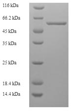 (Tris-Glycine gel) Discontinuous SDS-PAGE (reduced) with 5% enrichment gel and 15% separation gel.