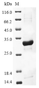 (Tris-Glycine gel) Discontinuous SDS-PAGE (reduced) with 5% enrichment gel and 15% separation gel.