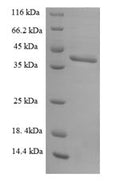 Recombinant Human U2 small nuclear ribonucleoprotein B (SNRPB2) – Figure 1 of 1