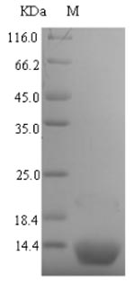 (Tris-Glycine gel) Discontinuous SDS-PAGE (reduced) with 5% enrichment gel and 15% separation gel.