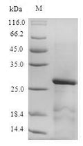 Recombinant Mouse Serine protease inhibitor Kazal-type 1 (Spink1) – Figure 1 of 1