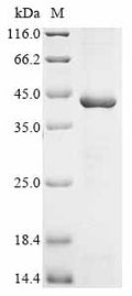 (Tris-Glycine gel) Discontinuous SDS-PAGE (reduced) with 5% enrichment gel and 15% separation gel.