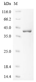 (Tris-Glycine gel) Discontinuous SDS-PAGE (reduced) with 5% enrichment gel and 15% separation gel.