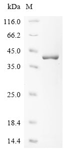 (Tris-Glycine gel) Discontinuous SDS-PAGE (reduced) with 5% enrichment gel and 15% separation gel.