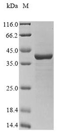 (Tris-Glycine gel) Discontinuous SDS-PAGE (reduced) with 5% enrichment gel and 15% separation gel.