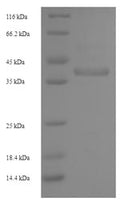 Recombinant Staphylococcus aureus Enterotoxin type G (entG) – Figure 1 of 1