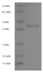 Recombinant Staphylococcus aureus Enterotoxin type G (entG) – Figure 1 of 1