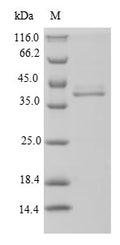 (Tris-Glycine gel) Discontinuous SDS-PAGE (reduced) with 5% enrichment gel and 15% separation gel.
