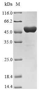 (Tris-Glycine gel) Discontinuous SDS-PAGE (reduced) with 5% enrichment gel and 15% separation gel.