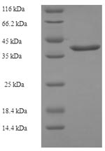 Recombinant Escherichia coli Cytidylate kinase (cmk) – Figure 1 of 1