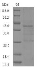 (Tris-Glycine gel) Discontinuous SDS-PAGE (reduced) with 5% enrichment gel and 15% separation gel.