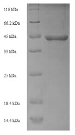 Recombinant Escherichia coli DNA repair protein recO (recO) – Figure 1 of 1