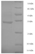Recombinant Escherichia coli Crossover junction endodeoxyribonuclease RuvC (ruvC) – Figure 1 of 1