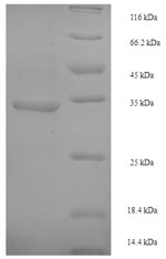 Recombinant Escherichia coli Crossover junction endodeoxyribonuclease RuvC (ruvC) – Figure 1 of 1