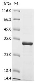 (Tris-Glycine gel) Discontinuous SDS-PAGE (reduced) with 5% enrichment gel and 15% separation gel.