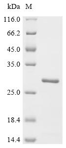 (Tris-Glycine gel) Discontinuous SDS-PAGE (reduced) with 5% enrichment gel and 15% separation gel.