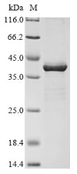 (Tris-Glycine gel) Discontinuous SDS-PAGE (reduced) with 5% enrichment gel and 15% separation gel.