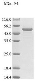 (Tris-Glycine gel) Discontinuous SDS-PAGE (reduced) with 5% enrichment gel and 15% separation gel.