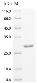 (Tris-Glycine gel) Discontinuous SDS-PAGE (reduced) with 5% enrichment gel and 15% separation gel.
