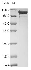(Tris-Glycine gel) Discontinuous SDS-PAGE (reduced) with 5% enrichment gel and 15% separation gel.