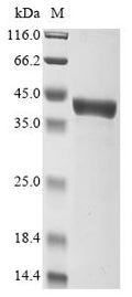 (Tris-Glycine gel) Discontinuous SDS-PAGE (reduced) with 5% enrichment gel and 15% separation gel.