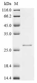 (Tris-Glycine gel) Discontinuous SDS-PAGE (reduced) with 5% enrichment gel and 15% separation gel.
