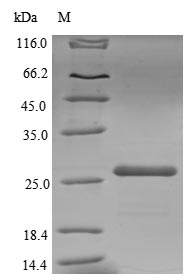 (Tris-Glycine gel) Discontinuous SDS-PAGE (reduced) with 5% enrichment gel and 15% separation gel.