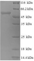 (Tris-Glycine gel) Discontinuous SDS-PAGE (reduced) with 5% enrichment gel and 15% separation gel.