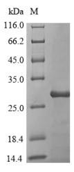(Tris-Glycine gel) Discontinuous SDS-PAGE (reduced) with 5% enrichment gel and 15% separation gel.